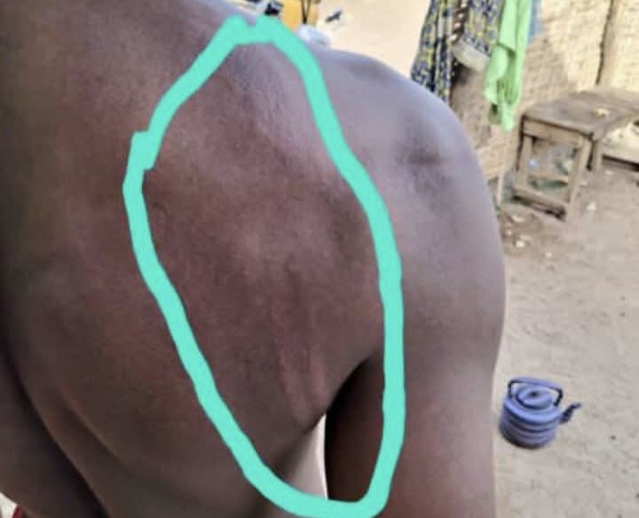 Diyabougou : un directeur d’école violemment battu pour quelques bidons d’eau